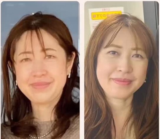 セラピスト本人の4年前と現在の比較写真